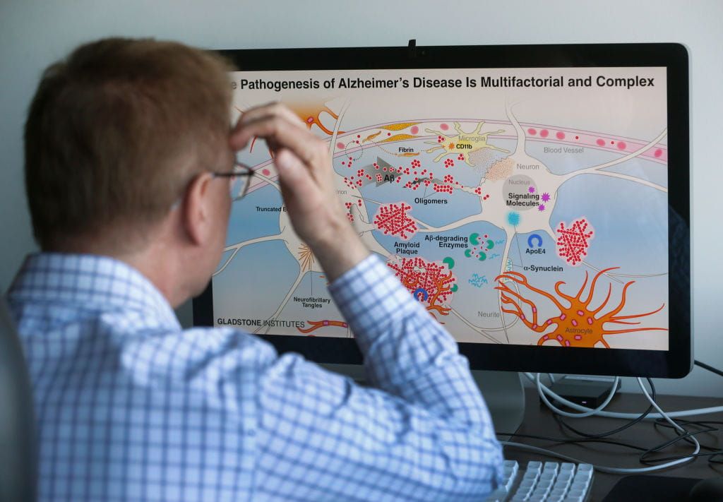 High on Health: A New Early Warning Sign for Alzheimer's