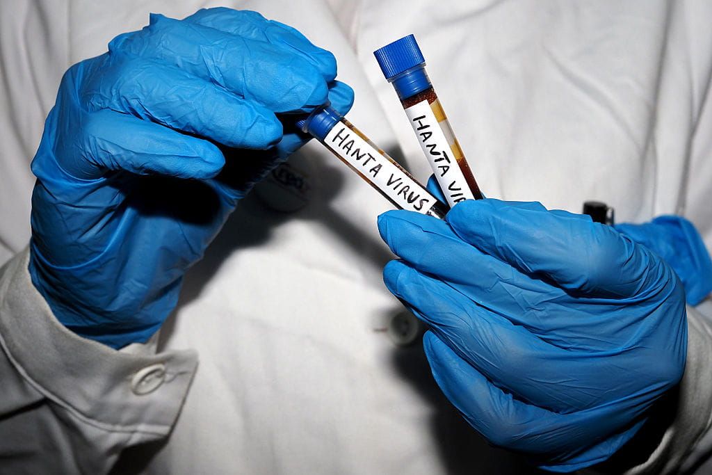 High on Health: What’s Going On With Hantavirus?
